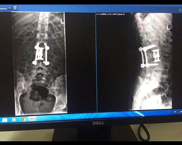 0_PAY-Ekaterina-Stetsyuk-X-ray-Ekaterina-Stetsyuk-east2west-news