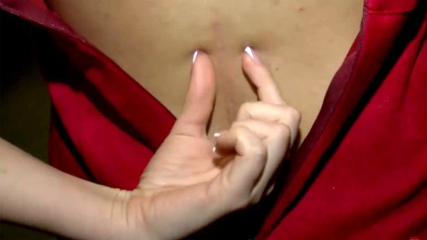 2_PAY-Ekaterina-Stetsyuk-TV-show-On-Air-Live-shows-her-scars-1-Rossiya-1-east2west-news
