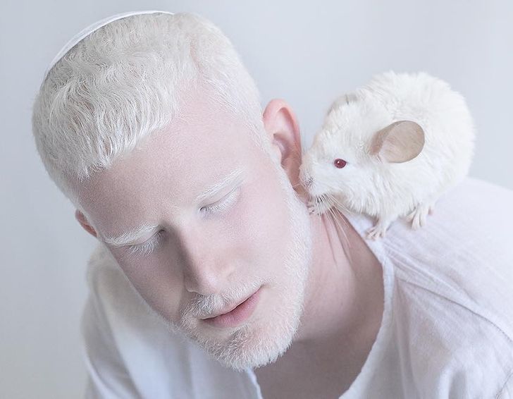 albinizmi (14)