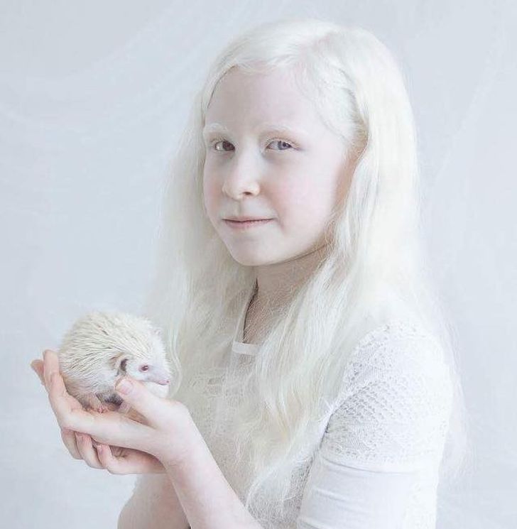 albinizmi (2)