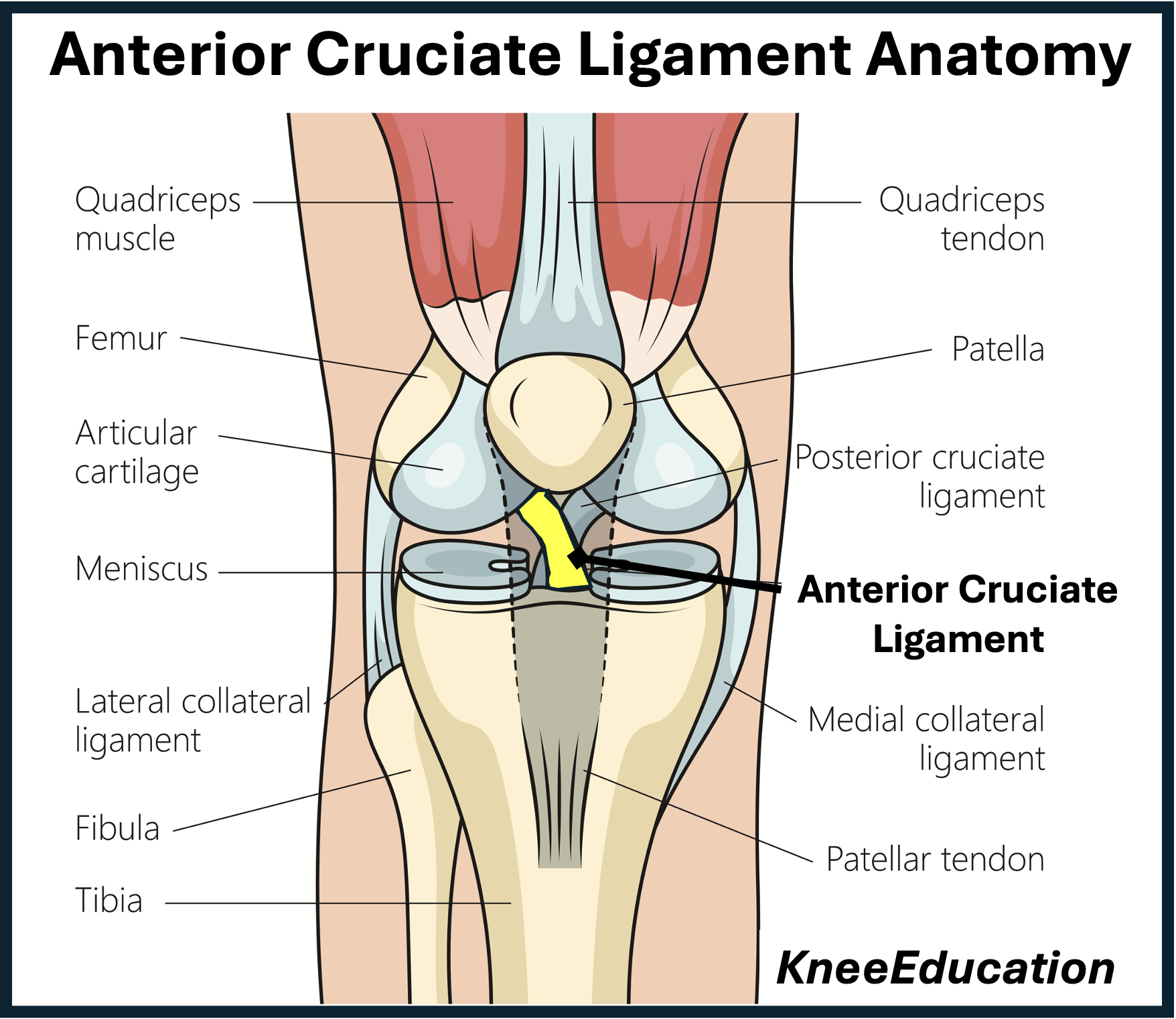 Anterior-Cruciate-Ligament-Anatomy