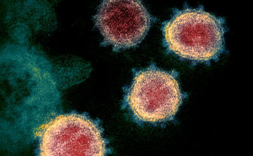 virus