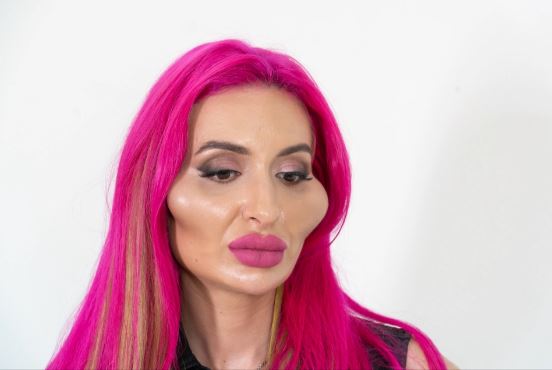 modelja, mollëzat (1)