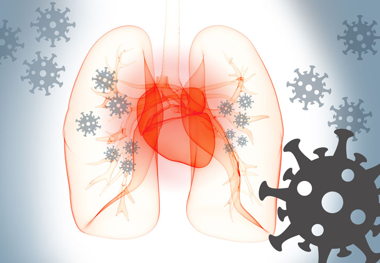 heartLungsCovid-1128597855-770x533-1