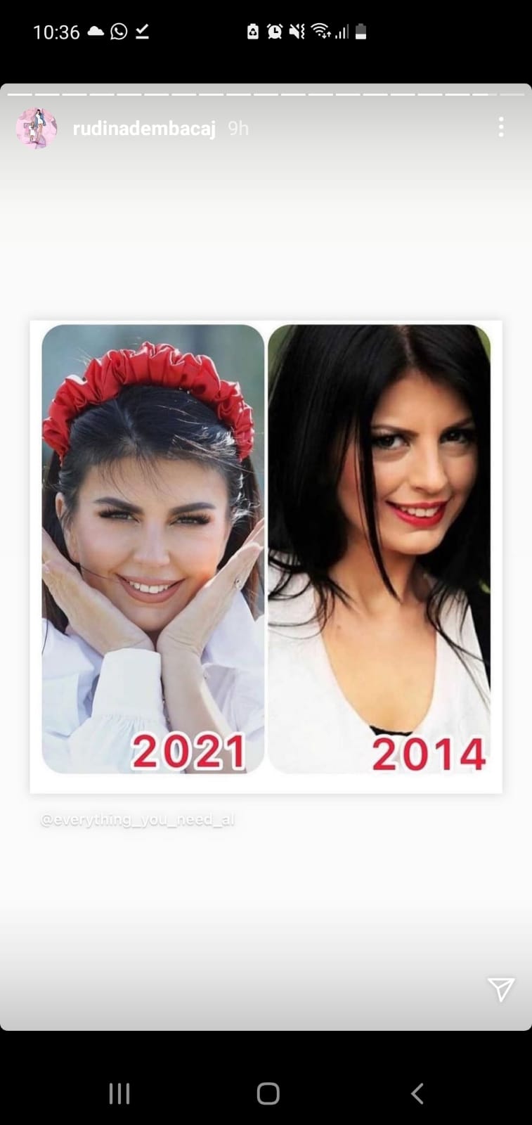 rudina dembacaj (6)