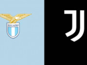 Hysaj i padiskutueshëm, bardhezinjtë lënë jashtë kapitenin. Publikohen formacionet zyrtare të Lacio-Juventus