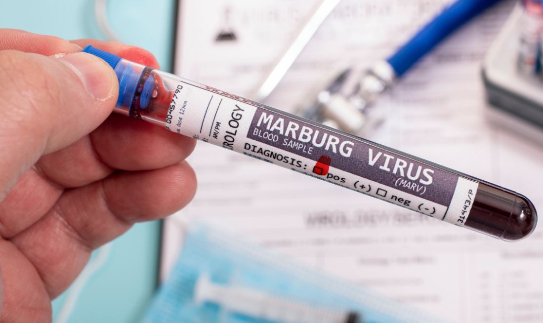 virus