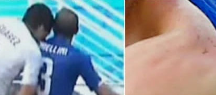 Histori nga Botërori   Vampiri  Suarez kafshoi sërish  Kielini viktima  167 bastexhinj pas atij gjesti