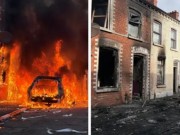Shpërthejnë protestat kundër emigrantëve në Irlandën e Veriut, shkak një sulm me thikë nga një azilkërkues! Digjen makina dhe ndërtesa, bllokohen rrugët (VIDEO)